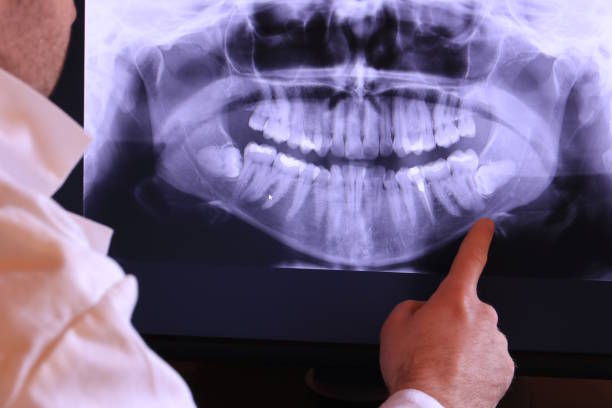 Best Emergency Treatment for Oral Infections in Mount Holly Springs, PA
