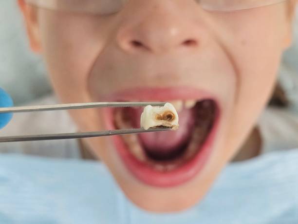 Best Emergency Treatment for Jaw Pain or Injury in Mount Holly Springs, PA