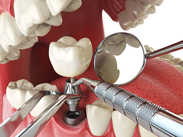 Best Walk-In Emergency Dental Services in Mount Holly Springs, PA